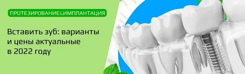 Где дешевле вставить зубы