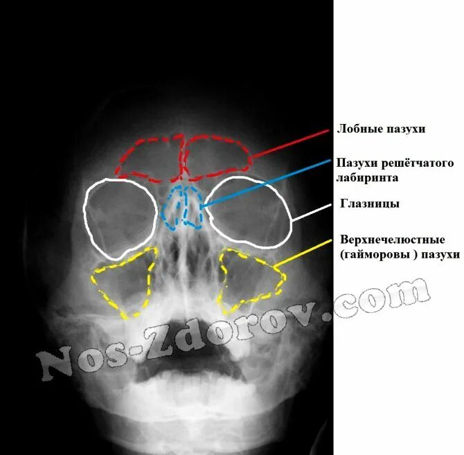 Рентген лобных пазух