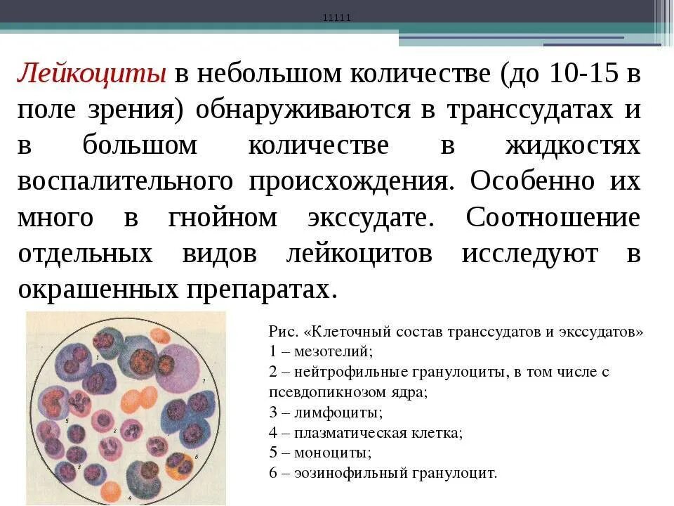 Лейкоциты качественно что это значит. Лейкоциты в моче 1/2 поля зрения. Лейкоциты в моче 2-3 в поле зрения. Лейкоциты микроскопия повышены. Лейкоциты в моче у ребенка 2.