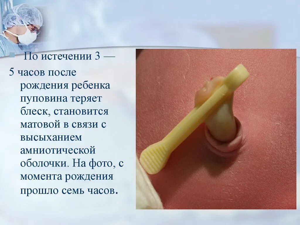 Перерезка пуповины алгоритм. Первичный туалет новорожденного обработка пуповины. Первичная и вторичная обработка пуповины. Обработка пуповины алгоритм