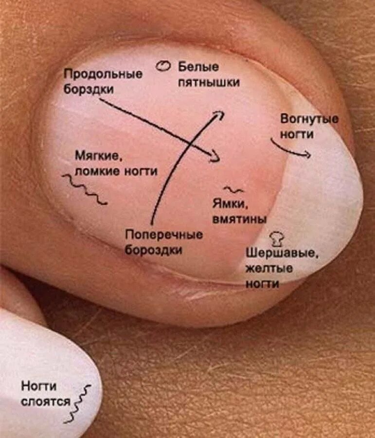 Цвет ногтей и их значение