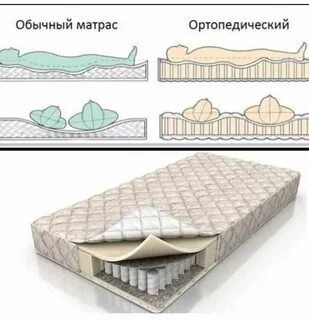 Анатомический и ортопедический разница