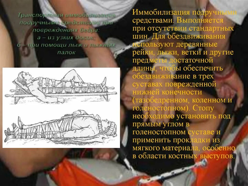 Первая помощь с использованием подручных средств. Иммобилизация выполняется с обездвиживанием …. для чего проводится обездвиживание травмированных. обездвиживание организма называется. иммобилизация подручными средствами.
