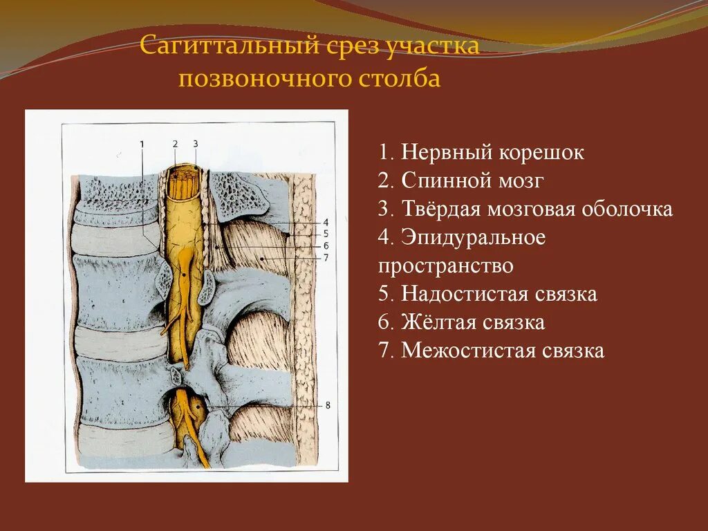 Эпидуральная спинная. Эпидуральное пространство спинного мозга. Надостистая связка. Срез позвоночного канала. Эпидуральном пространстве позвоночного канала.