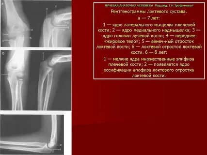 Локтевой сустав анатомия рентген