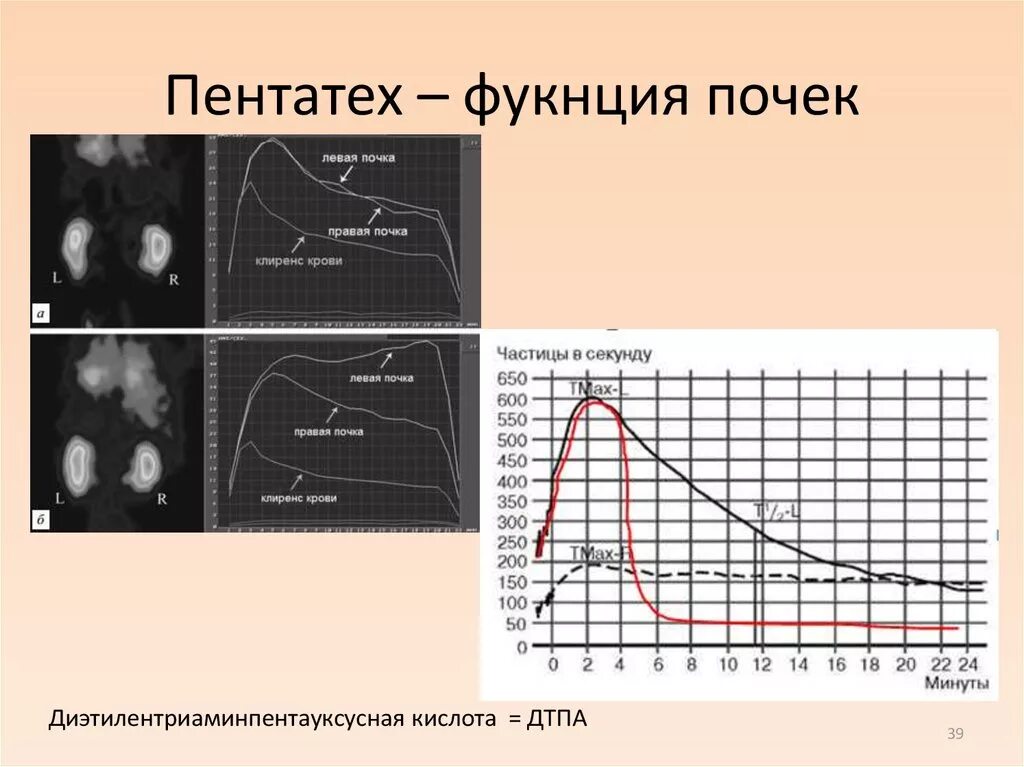 Пентатех. ДТПА (диэтилентриаминпентауксусная кислота). Диэтилентриаминпентауксусная кислота для оценки кровотока в почках. Диагностика почек и печени радиофармпрепаратами технеция и DTPA. Препарат активностью частиц в секунду