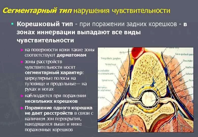 Типы поражения чувствительности. Сегментарный Тип расстройства чувствительности. Корешковый Тип расстройства чувствительности. Сегментарные и проводниковые нарушения. Типы чувствительных нарушений корешковый.