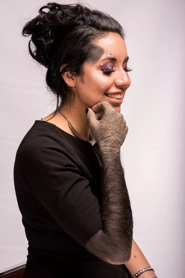 Большие родимые. Большие родимые. Красивая спина с родинками. Красивые девушки с родимыми пятнами. Большие родимые.