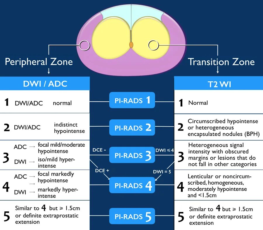 Предстательная железа по Pirads. Pi-rads 2-5. ДГПЖ Pi rads 2. Pi-rads 3-4.