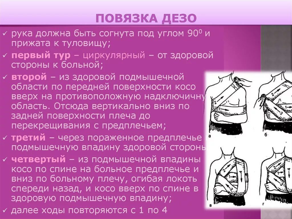 Плечевая повязка алгоритм. Порядок наложения повязки Дезо. Технику наложения повязки Дезо.. Наложение повязки Дезо алгоритм. Повязка Дезо последовательность действий.