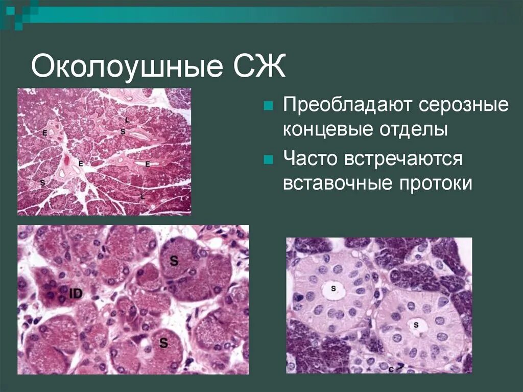 Околоушная слюнная железа гистология. Околоушная слюнная железа препарат. Вставочный проток околоушной железы. Околоушная слюнная железа гистология препарат. Препарат околоушной железы