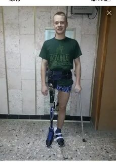 Потерял конечность