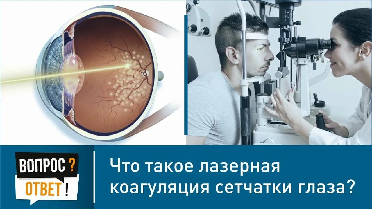 Периферическая лазеркоагуляция сетчатки глаза. Лазерная коагуляция сетчатки. Лазерная коррекция сетчатки. Коагуляция сетчатки глаза лазером.