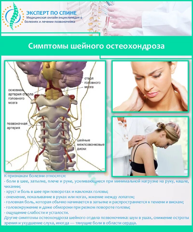 Спина болит признаки. Остеохондроз шейного отдела позвоночника. Шейный остеохондроз позвонки шейного отдела. Шейный остеохондроз отде. Остеохондроз шейного отдела симптомы.