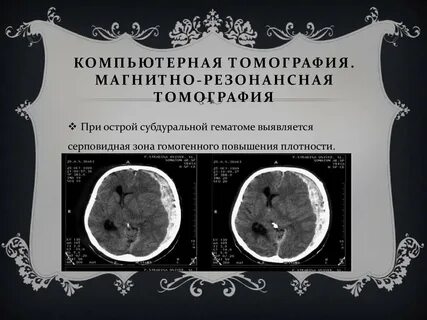 Кт показания