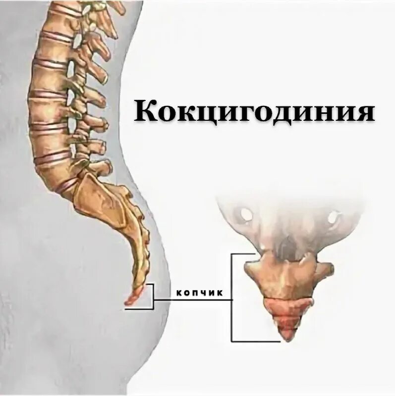 строение копчикового позвонка. копчиковый отдел позвоночника рентген. копчиковые позвонки рудимент. что едят копчики. скелет позвоночника человека.