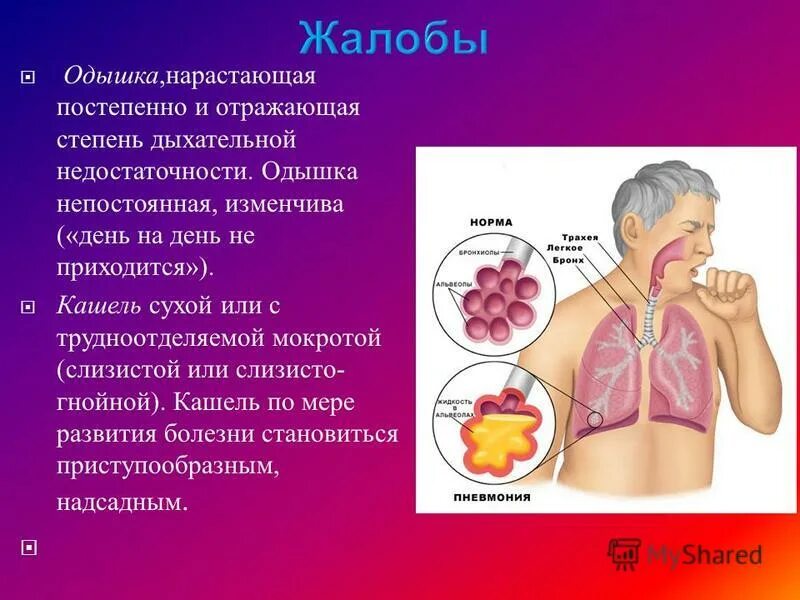 Кашель с трудной мокротой