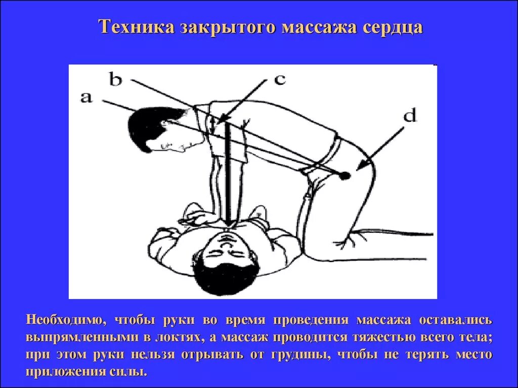 Руки при непрямом массаже