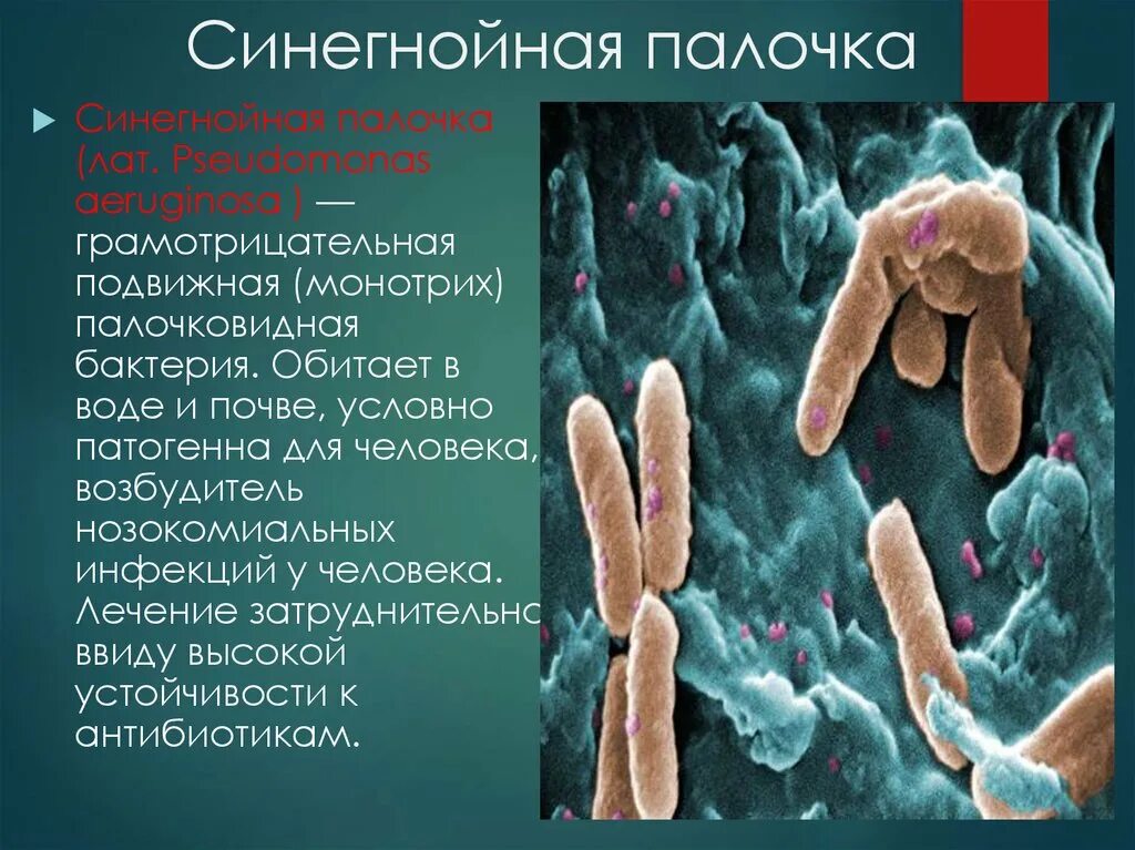 Гнойная бактерия. Синегнойная палочка внутрибольничная инфекция. Инфекции вызванные синегнойной палочкой. Симптомы заболевания синегнойной палочкой. Бактериальная инфекция (синегнойная палочка).