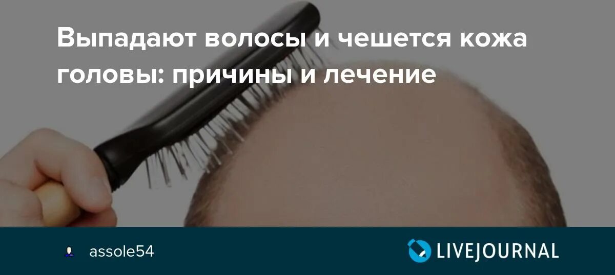 Чешется голова и выпадают волосы. Зудится кожа головы и выпадают волосы. Зудит кожа головы и выпадают волосы. Голова чешется и выпадают волосы отчего.