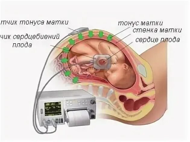Тонус матки внизу живота