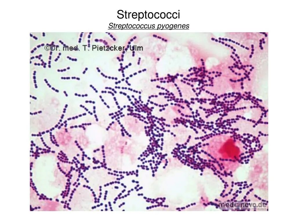 Пиогенные стрептококки. Стрептококки генцианвиолет. Streptococcus pyogenes мазок. Streptococcus pyogenes микроскопия.
