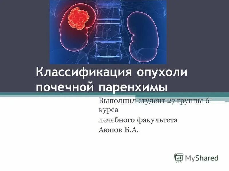 Рак почки инвалидность. Опухоли паренхимы почек. Презентация на тему опухоли почек. Опухоли почек классификация. Папиллярная опухоль почки.