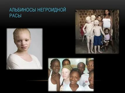 Генотип альбиноса