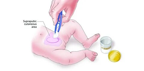 За сколько можно собрать мочу ребенка