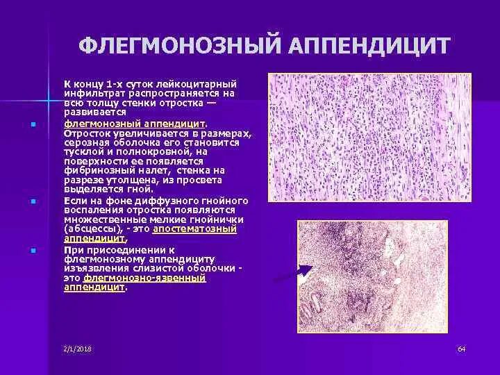 Диффузная лимфоцитарная инфильтрация