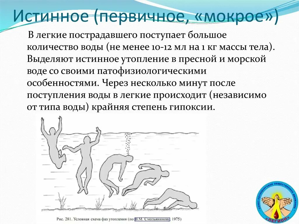 Утопление в пресной воде. Патогенез утопления в пресной воде. Утопление в морской воде. Истинное утопление в морской воде.