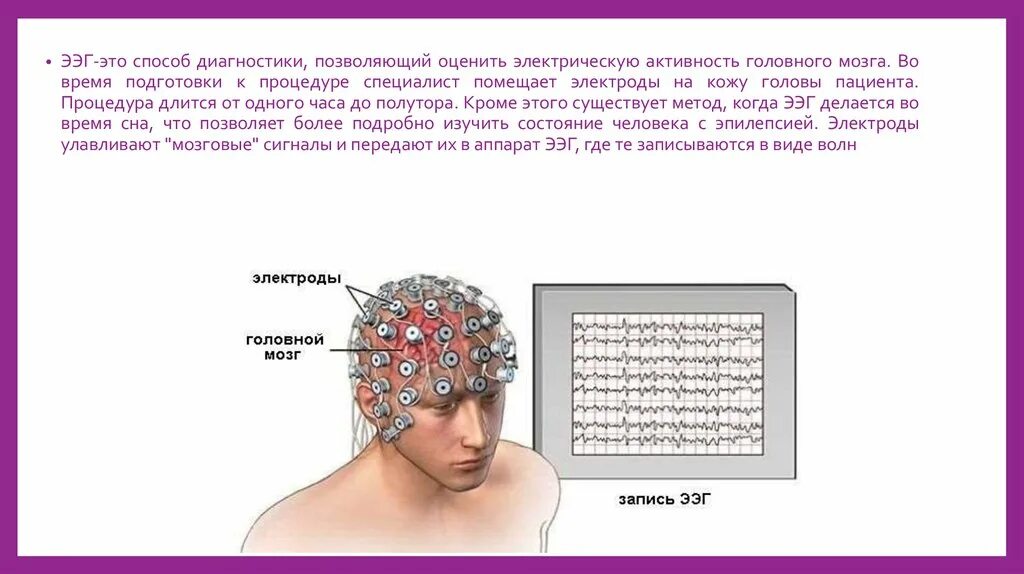 Ээг сколько длится процедура. Ээг 19 электродов. электрод для кожи. картинки ээг электроды на голове.
