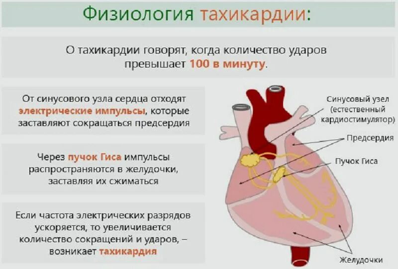 Нормальное сердцебиение кардиограмма. Учащенное сердцебиение тахикардия. Тахикардия. Кардиология аритмии. Учащения сердечного ритма.