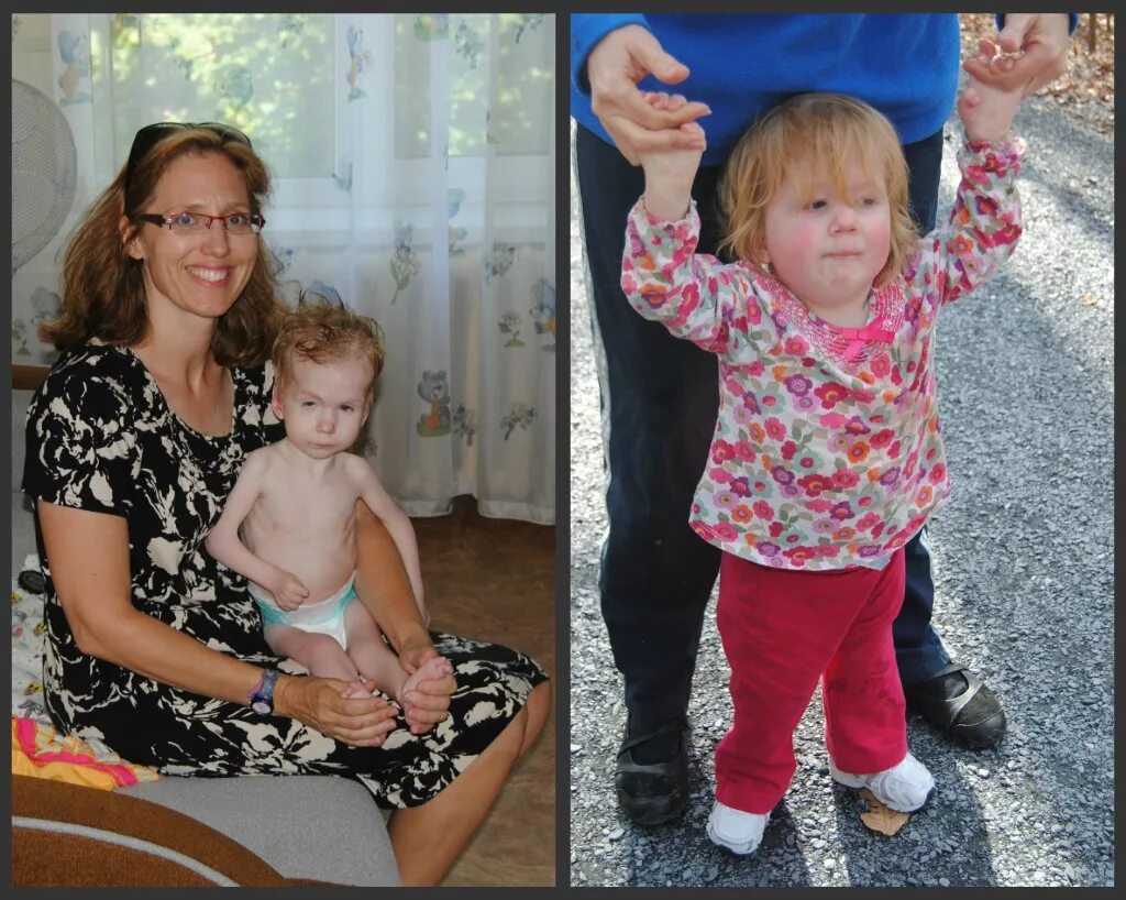 Усыновленные дети до и после. Дети из детдома до и после усыновления. Ребенок до и после. Детки до и после усыновления.