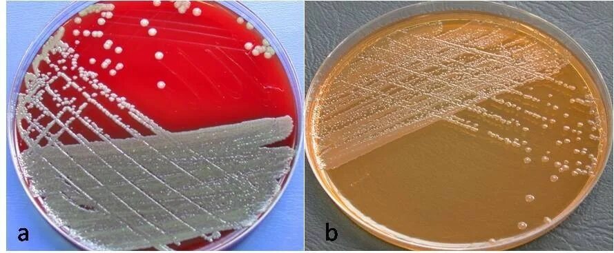 Elizabethkingia meningoseptica микробиология. Посев Shigella SPP., Salmonella SPP.. Вейлонеллы микробиология. Посев на возбудителей кишечной группы (Shigella SPP., Salmonella SPP.). Посев на сальмонеллез