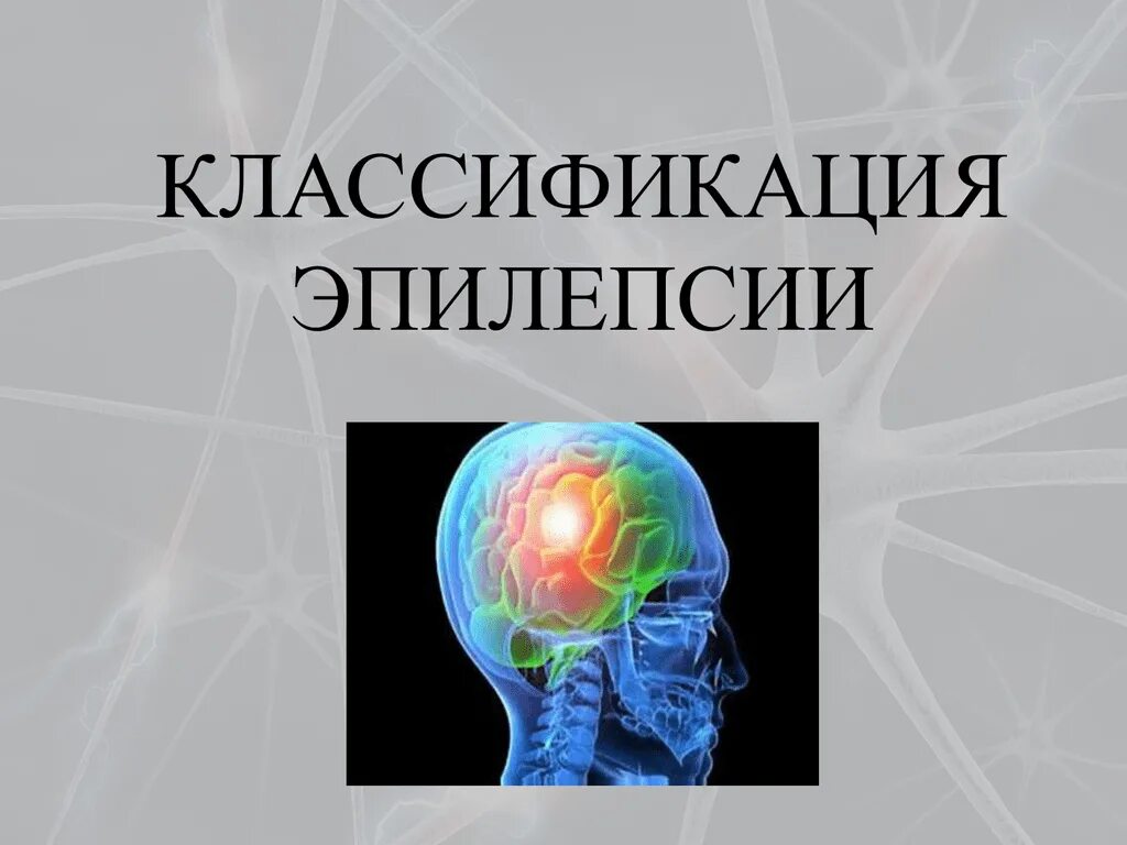 Классификация эпилепсии. Эпилепсия классификация припадков. Классификация эпилептических припадков. Эпиприступы классификация. Невролог эпилепсия