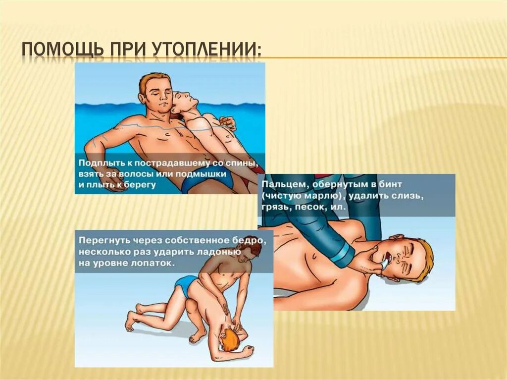 Реферат по оказанию помощи утопающему. Первая помощь утопающему. Первая помощь при утоплении. Оказание первой помощи при утоплении электротравме. Как помочь утопающему человеку.