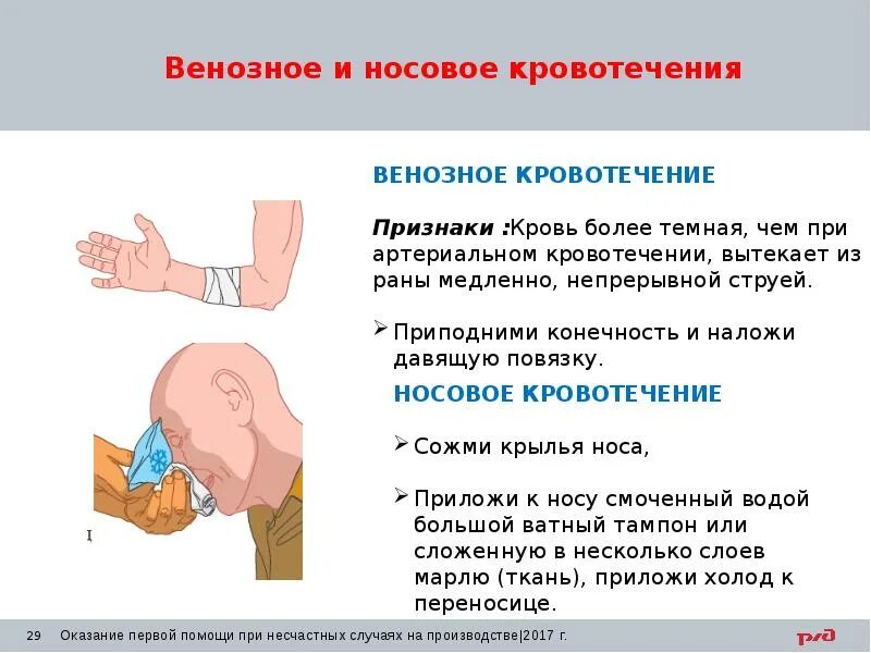 Пострадавшему с сильным наружным кровотечением. Венозная симптомы и первая помощь. Венозноеное кровотечение. Признаки виновного кровотечения. Артериальное кровотечение.