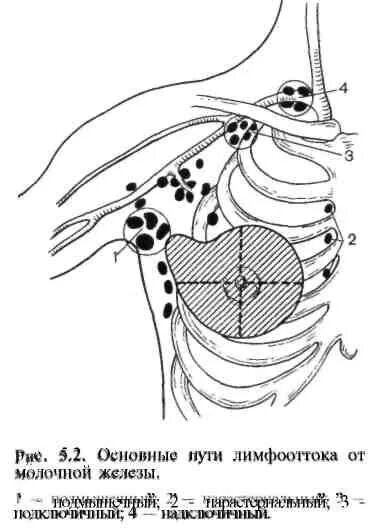 Топография молочной железы, лимфоотток. Лимфатические узлы молочной железы анатомия. Лимфоузлы молочных желез строение. Лимфоотток молочной железы топографическая анатомия. Лимфоузлы при рмж
