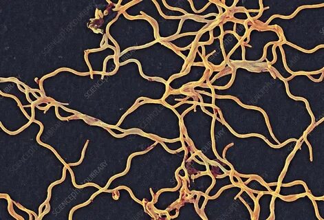 Borrelia burgdorferi