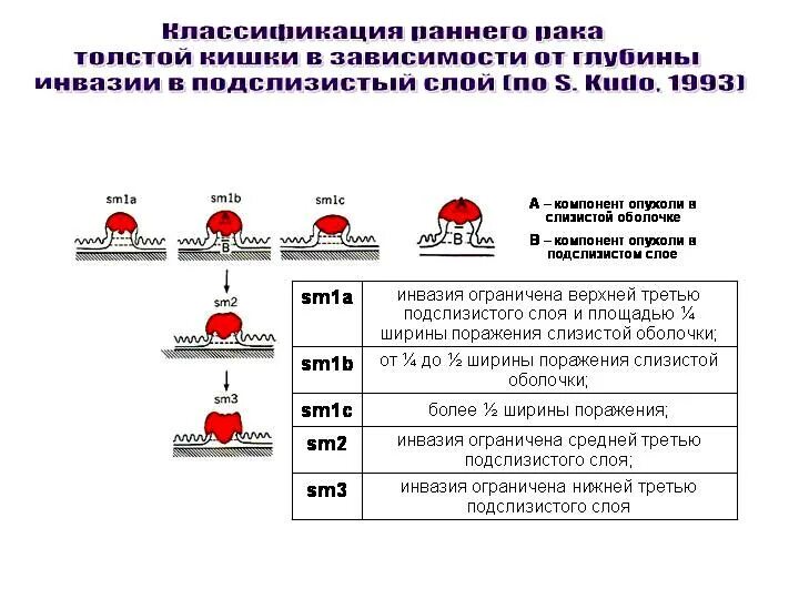 Тип 0 is. Полипоз толстой кишки классификация. Эпителиальное новообразование ободочной кишки тип0-LS. Парижская классификация образований толстой. Классификация полипов желудка эндоскопическая.