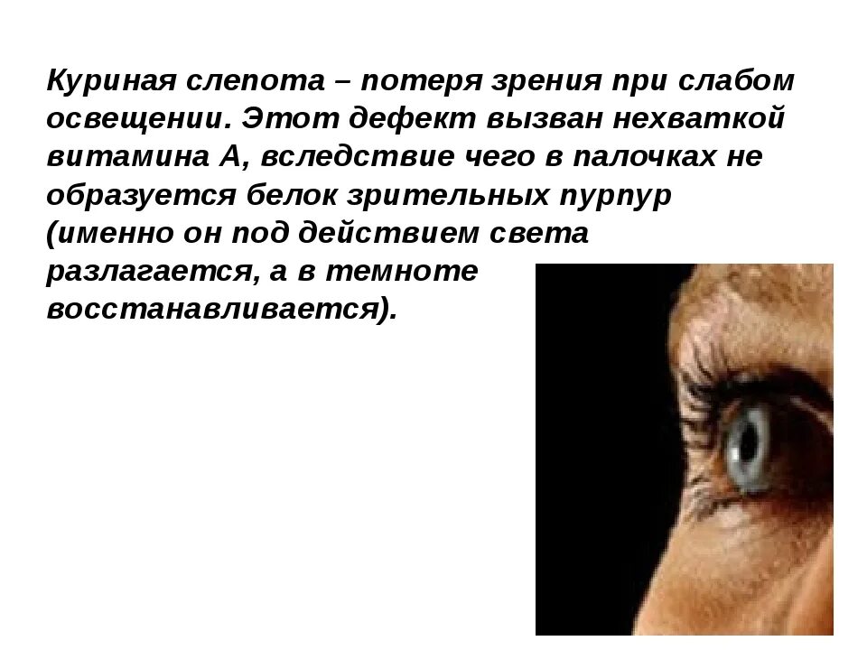 Человека с нарушением зрения называют. Куриная слепота болезнь. Гемералопия (куриная слепота). Куриная слепота — расстройство сумеречного зрения..