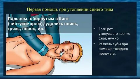 Асфиксия утопление электротравма конспект