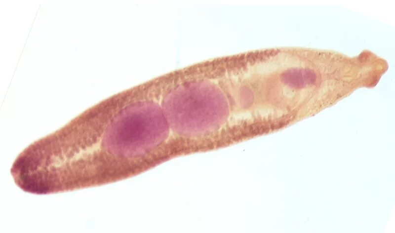 Черви сосальщики. Двуустка китайская (Clonorchis sinensis). Кишечный сосальщик