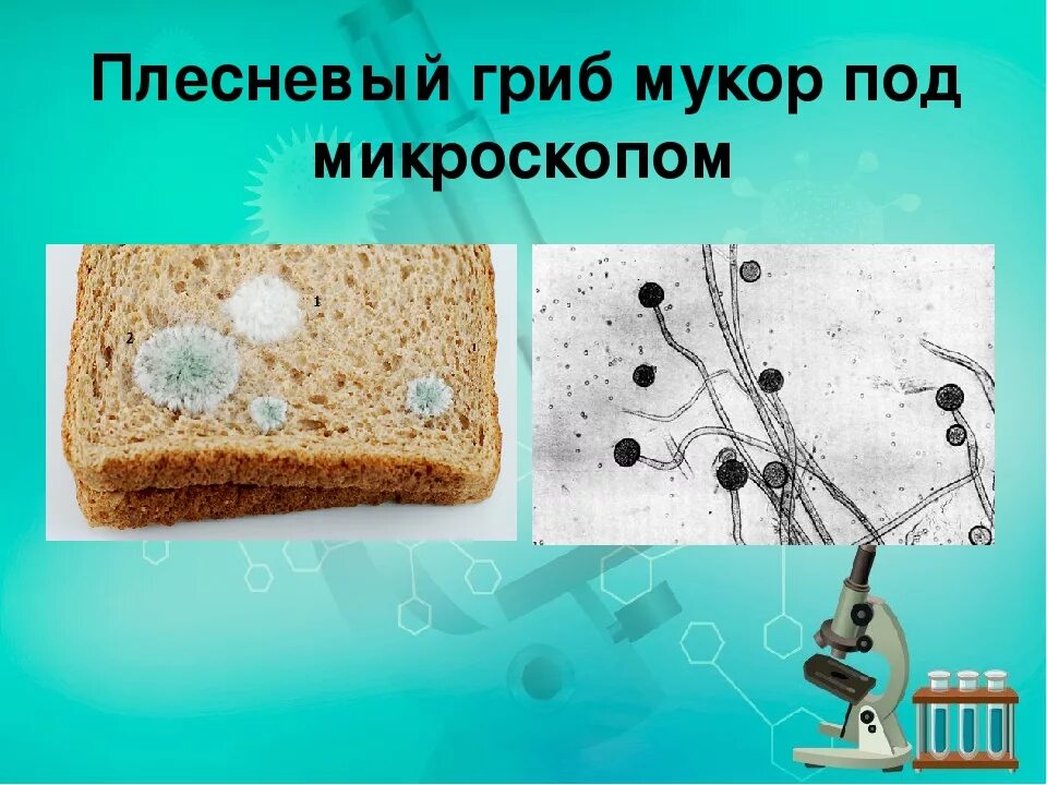 Микропрепарат плесневого гриба мукора под микроскопом. Рассмотрите микропрепарат плесени гриба мукора. Строение плесени под микроскопом. Клетка плесени мукора под микроскопом. Плесневые грибы часто появляются на хлебе