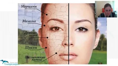 Как солнце влияет на кожу