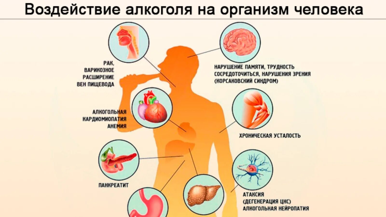 Виски орган человека. Алкоголизм воздействие на организм кратко. Алкоголизмии воздействие на организм.