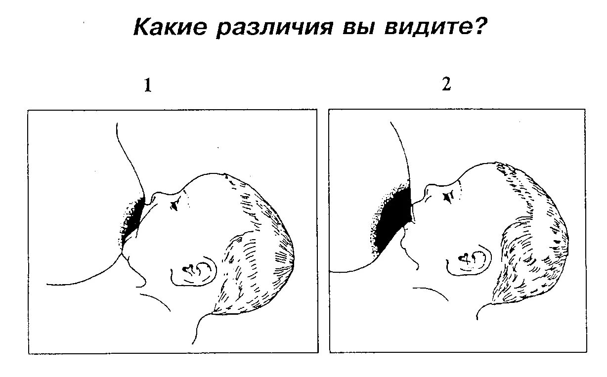 Правильное и неправильное прикладывание к груди. Правильное прикладывание ребенка при грудном вскармливании. Правильное и неправильное прикладывание ребенка к груди. Захват при грудном вскармливании.