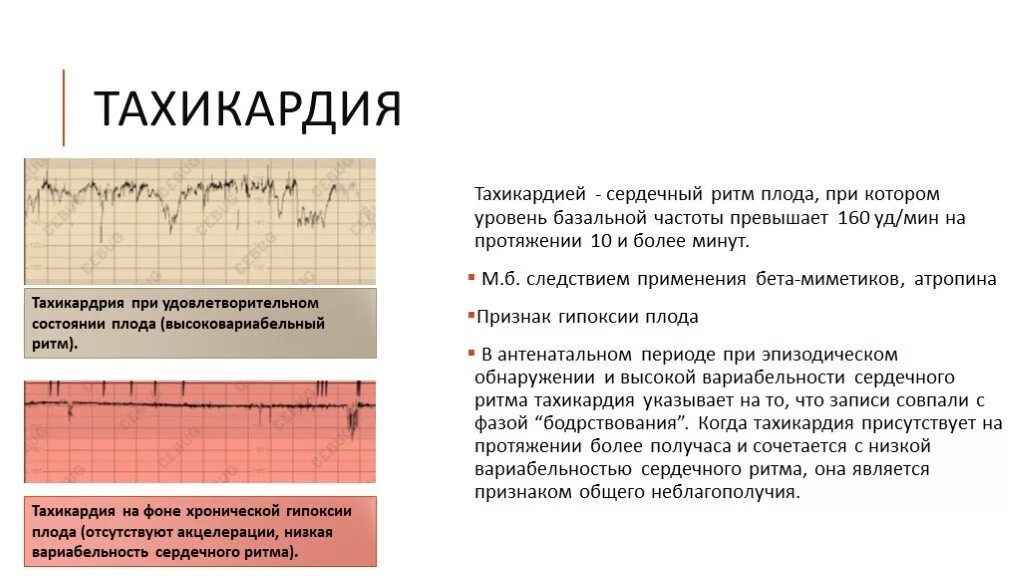 Сильное сердцебиение температура