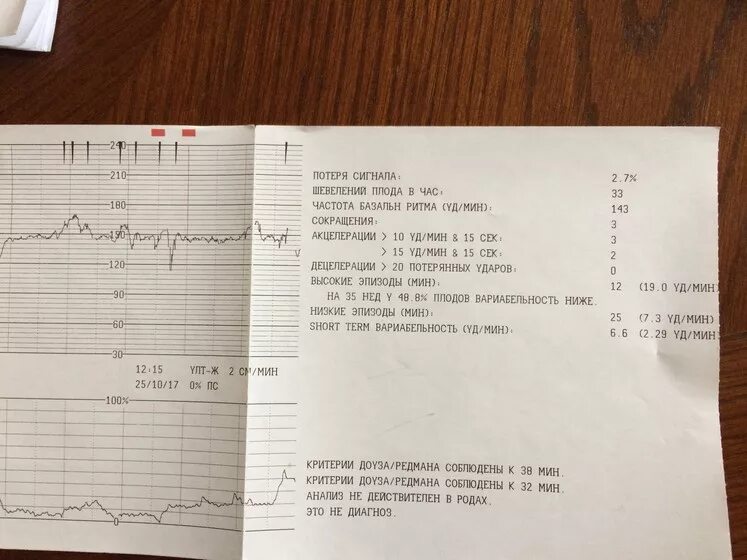 Тест плода считать до 10. Шевеления на КТГ 156. КТГ ребенок спал.